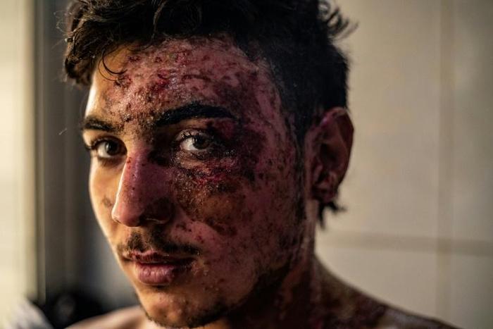 More than 250 fighters of the Kurdish-led Syrian Democratic Forces (SDF) have been killed and many more wounded since Turkey launched its cross-border offensive on October 9, according to the Syrian Observatory for Human Rights