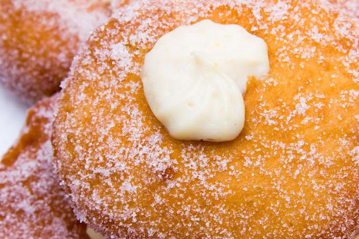 Dr. Pimple Popper Squeezes Cream Steatocystomas