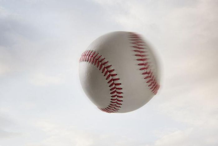 Dr. Pimple Popper Pops Flying Pilar Cyst