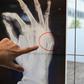 A Milan hospital is displaying X-rays from victims of domestic violence who have passed through the doors of the facility seeking help