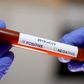 Update: Ghana’s COVID-19 case count jumps to 636