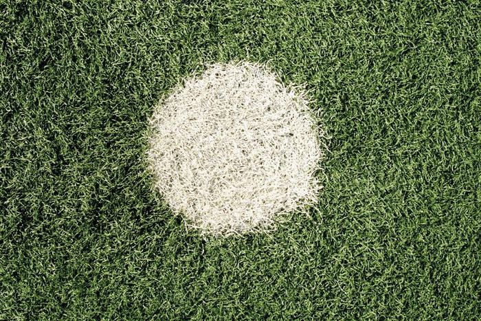 Dr. Pimple Popper Squeezes A Juicy Whitehead