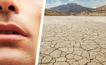 Why You Have a Dry Mouth—and How to Fix It