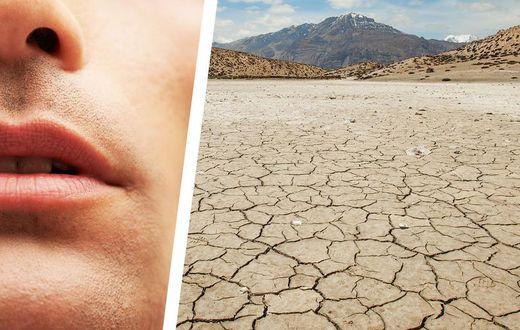 Why You Have a Dry Mouth—and How to Fix It