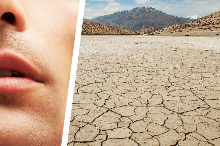 Why You Have a Dry Mouth—and How to Fix It