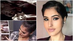 Ultrasound scan shows a pregnant woman’s late father kissing her unborn baby inside her womb (video)