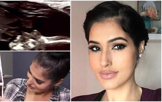 Ultrasound scan shows a pregnant woman’s late father kissing her unborn baby inside her womb (video)