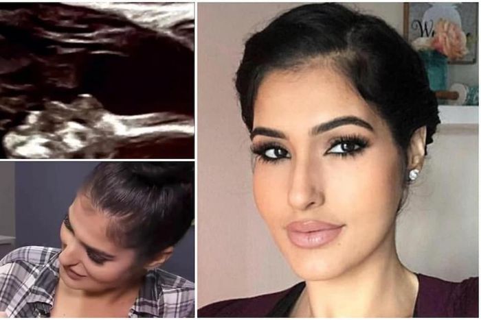 Ultrasound scan shows a pregnant woman’s late father kissing her unborn baby inside her womb (video)