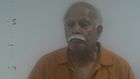 Virginia Doctor Performed Hysterectomies Without Consent, Prosecutors Say