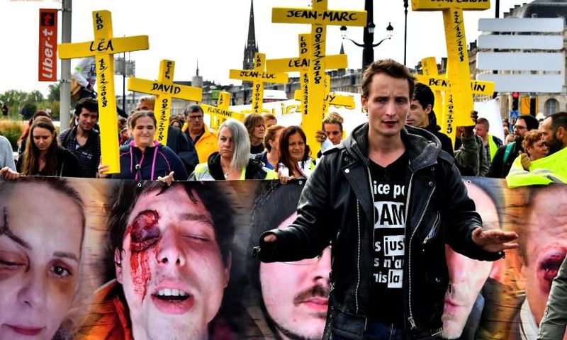 Antoine Boudinet, a protester who lost his right hand to a GLI-F4 stun grenade at a protest by injured protesters last September in Bordeaux