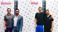 Men are now resorting to limb extension surgery to become taller (video)