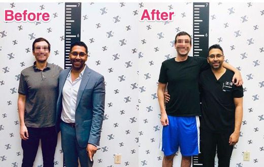 Men are now resorting to limb extension surgery to become taller (video)