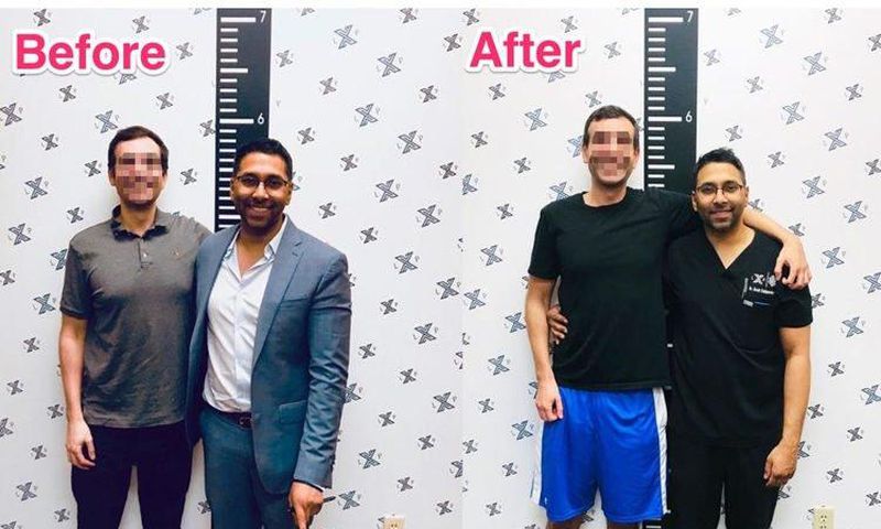 Men are now resorting to limb extension surgery to become taller (video)