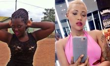 Farcadi before and after bleaching