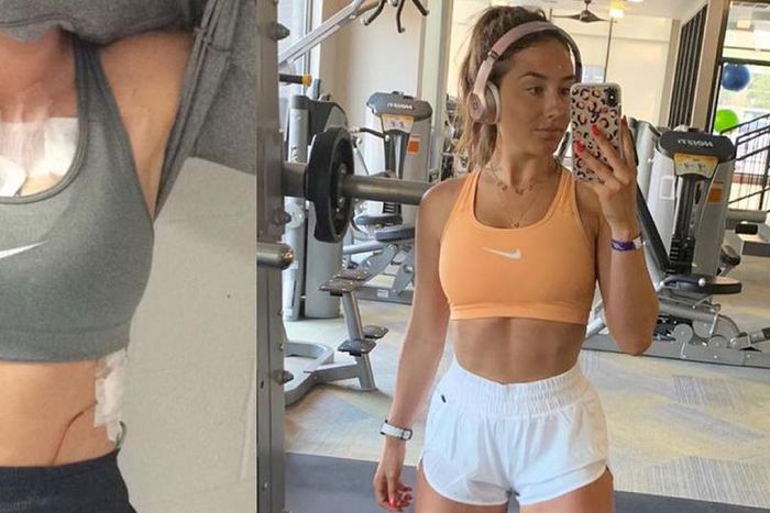 'Exercising With Mono Almost Killed Me'