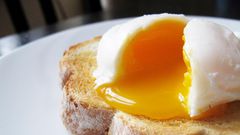 Dr. Pimple Pops the 'Yolk' of a 'Poached Egg' Cyst