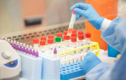 Coronavirus: Why Gov’t must supply free test kits to encourage mass and voluntary testing