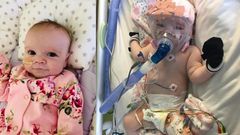 6-month-old baby survives open-heart surgery, gets infected with COVID-19 again; mom seeks prayers