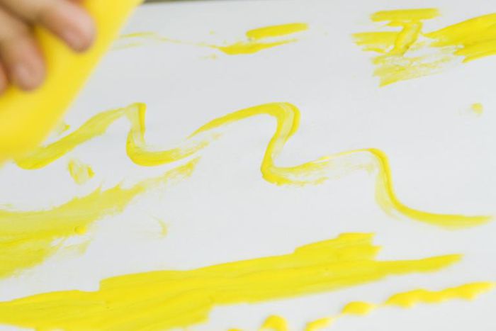 Watch Dr. P Pop A Squirting Scalp Cyst