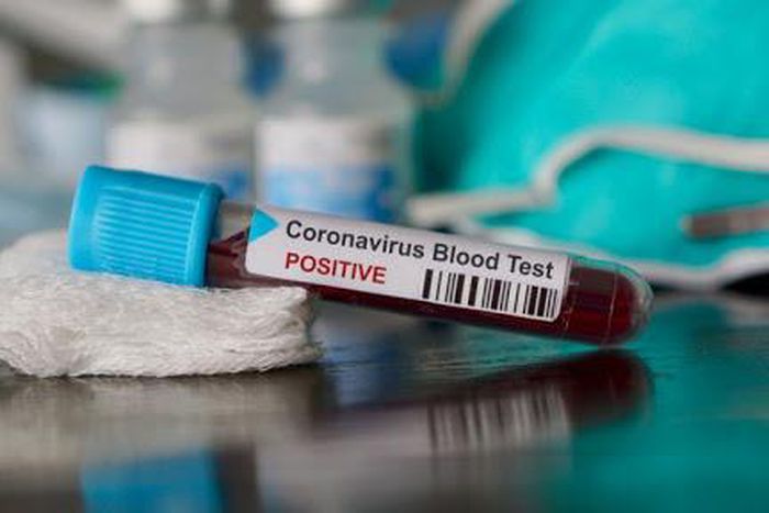 COVID-19: Ghana records 414 new infections, case count moves up to 24,248