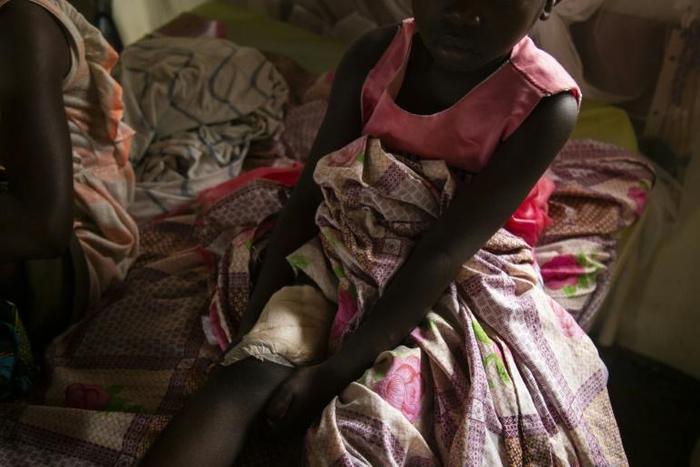 Nine-year-old Edwige Kalivanda is just one of many people being treated for horrific wounds and trauma from attacks by rebels in DR Congo