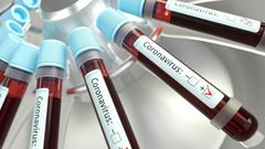 Coronavirus: Ghana’s COVID-19 death toll now 6