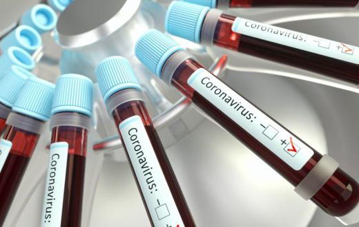 Coronavirus: Ghana’s COVID-19 death toll now 6