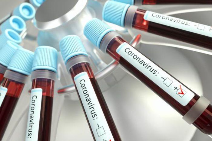 Coronavirus: Ghana’s COVID-19 death toll now 6