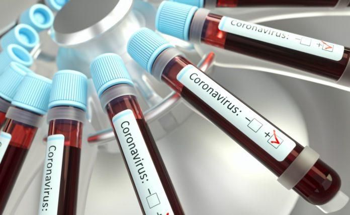 Coronavirus: Ghana has 83 recoveries as at April 16