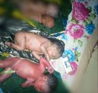 30-year-old mother of 12 gives birth to another quadruplet at home; no antenatal care