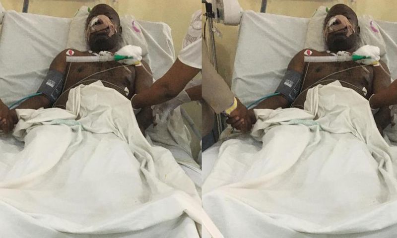 Wife cuts off doctor husband’s nose, tongue, teeth, gums before calling his mom to come for the corpse
