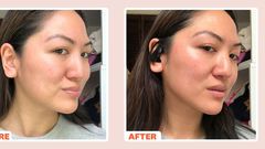 What Is a Microcurrent Facial?