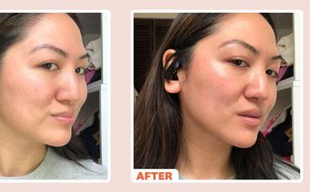 What Is a Microcurrent Facial?