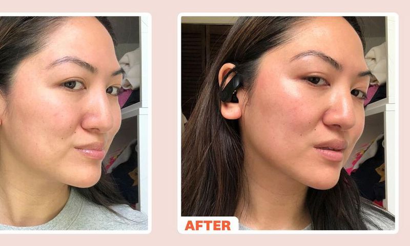 What Is a Microcurrent Facial?