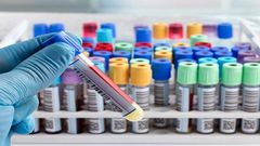 Covid-19 cases in Ghana skyrocket to 287