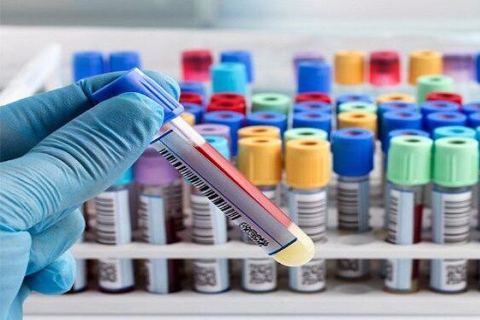 Covid-19 cases in Ghana skyrocket to 287