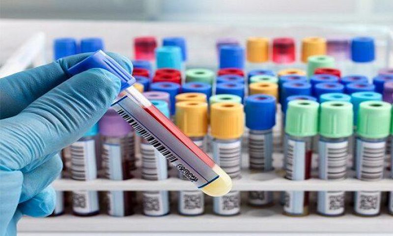 Covid-19 cases in Ghana skyrocket to 287