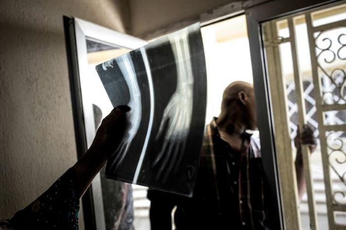 Volunteer doctors have been treating wounded supporters of Guinea's beleaguered political opposition in a secret clinic