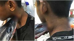 Needlefish stabs boy in the neck injuring him severely