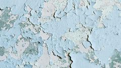 How to Treat Dry Skin, According to A Derm