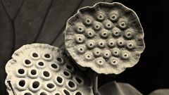 Dr. Pimple Popper Pops a Huge Crusty Blackhead