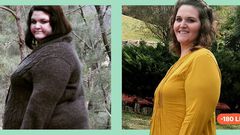 'I've Kept Off 183 Lbs. Since Bariatric Surgery'