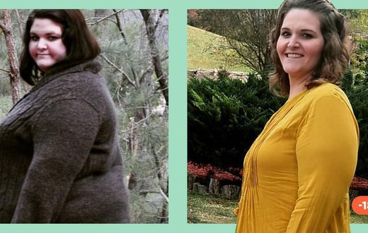'I've Kept Off 183 Lbs. Since Bariatric Surgery'