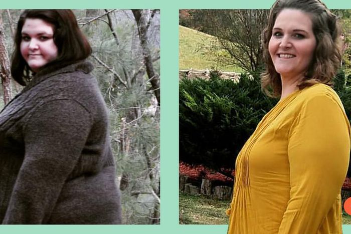 'I've Kept Off 183 Lbs. Since Bariatric Surgery'