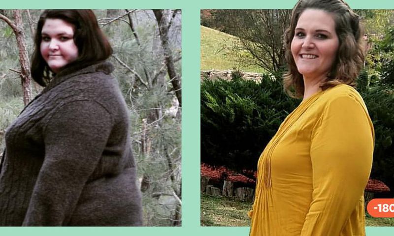 'I've Kept Off 183 Lbs. Since Bariatric Surgery'