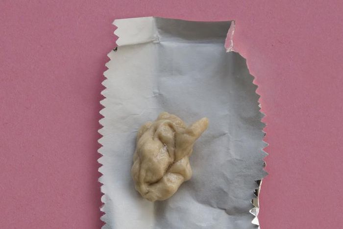 Dr. Pimple Popper Removes a Chewed Gum Lipoma