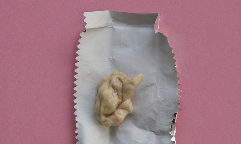 Dr. Pimple Popper Removes a Chewed Gum Lipoma