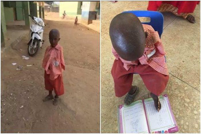 It’s heart-touching how 4-year-old armless schoolboy uses his toes to write