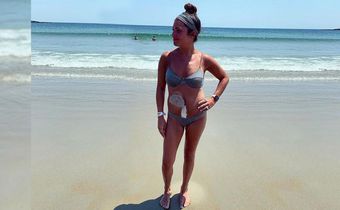 What It's Like To Be A 30-Year-Old Without A Colon