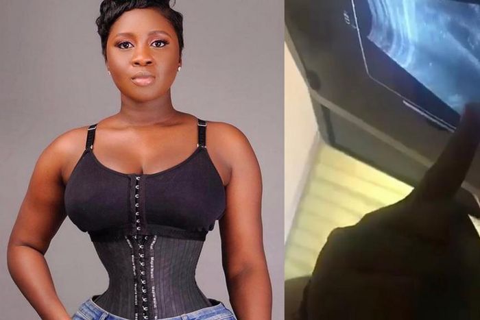 Princess Shyngle is pregnant according to this ultrasound scan